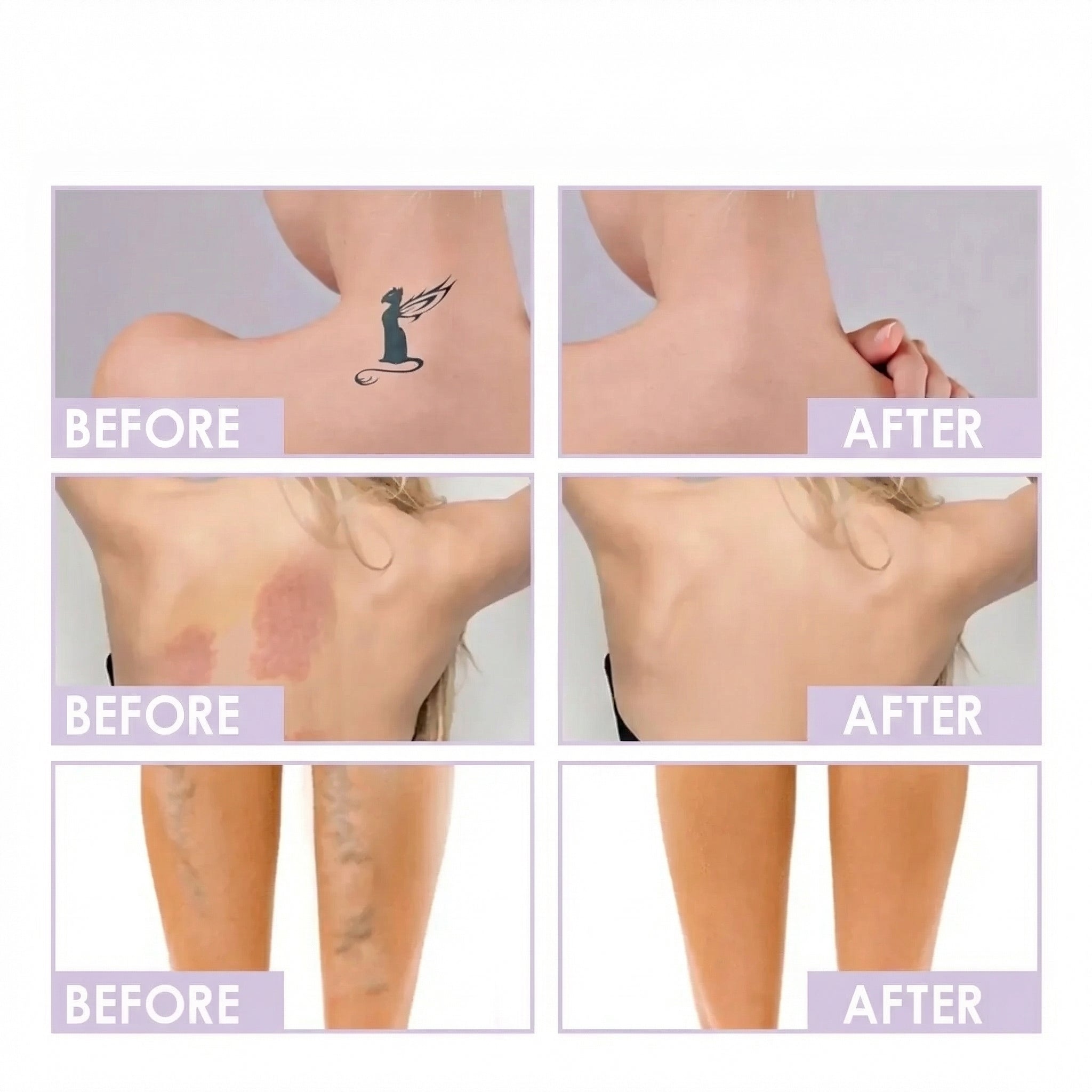 Before and after chest coverage